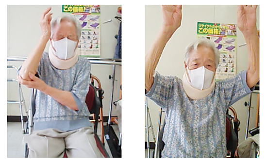 遠絡療法による肩の可動域の改善