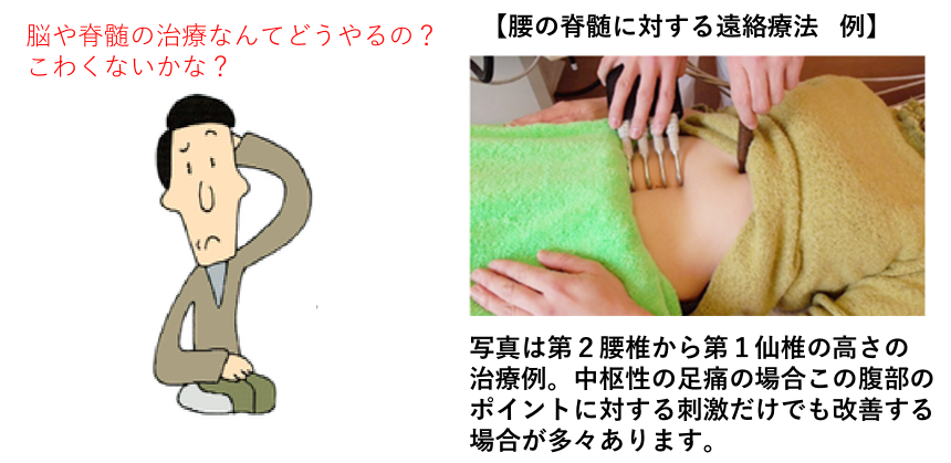遠絡療法による中枢の治療